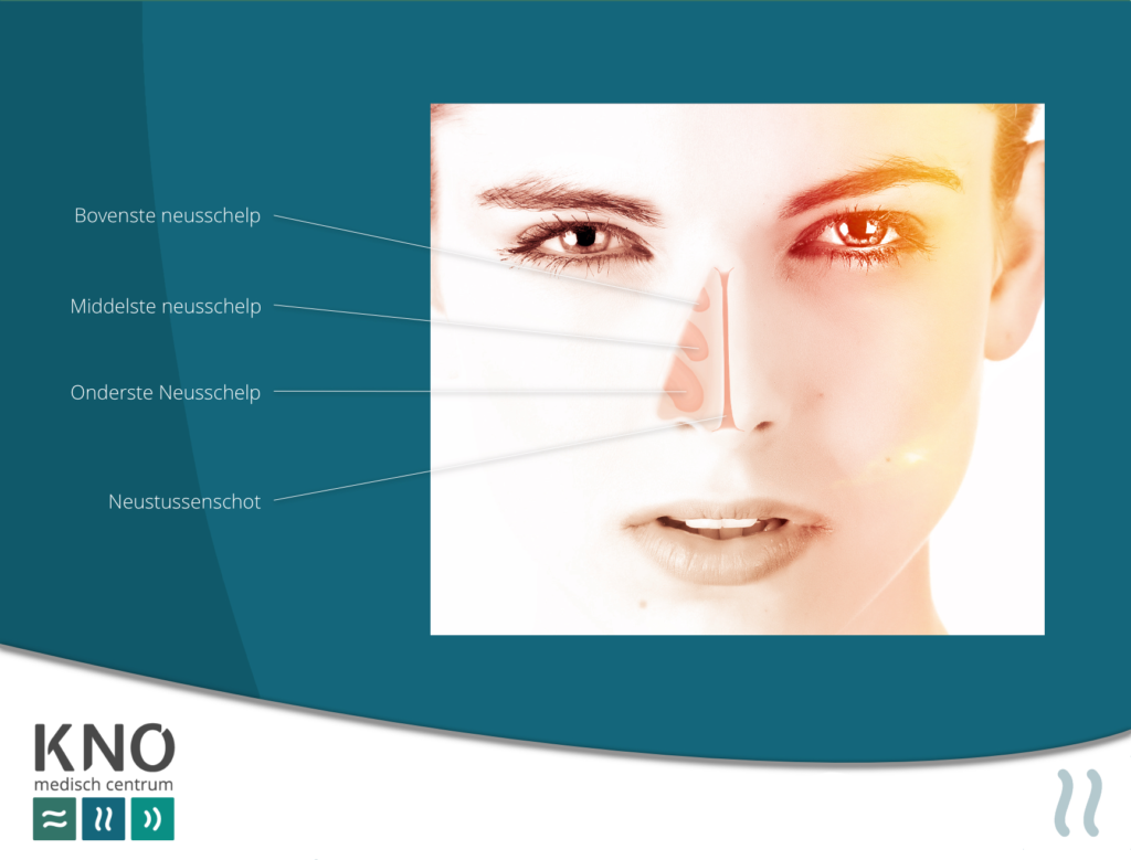 KNO Medisch Centrum droge neus
