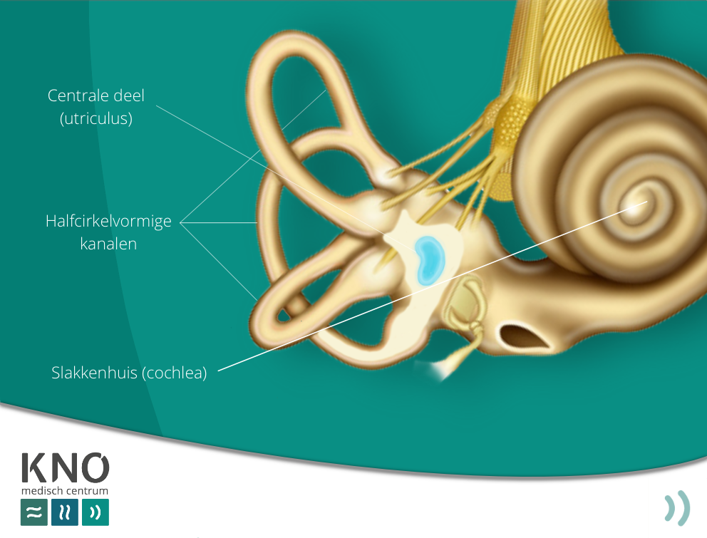 vestibulaire migraine