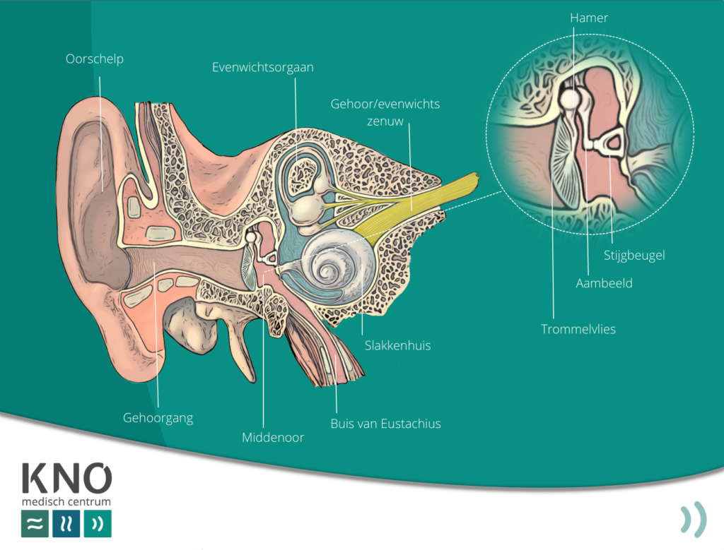 plotsdoofheid (sudden deafness)