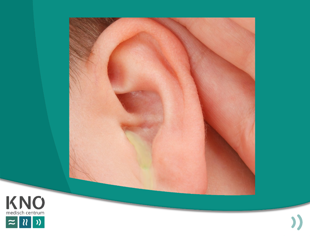 KNO Medisch Centrum loopoor