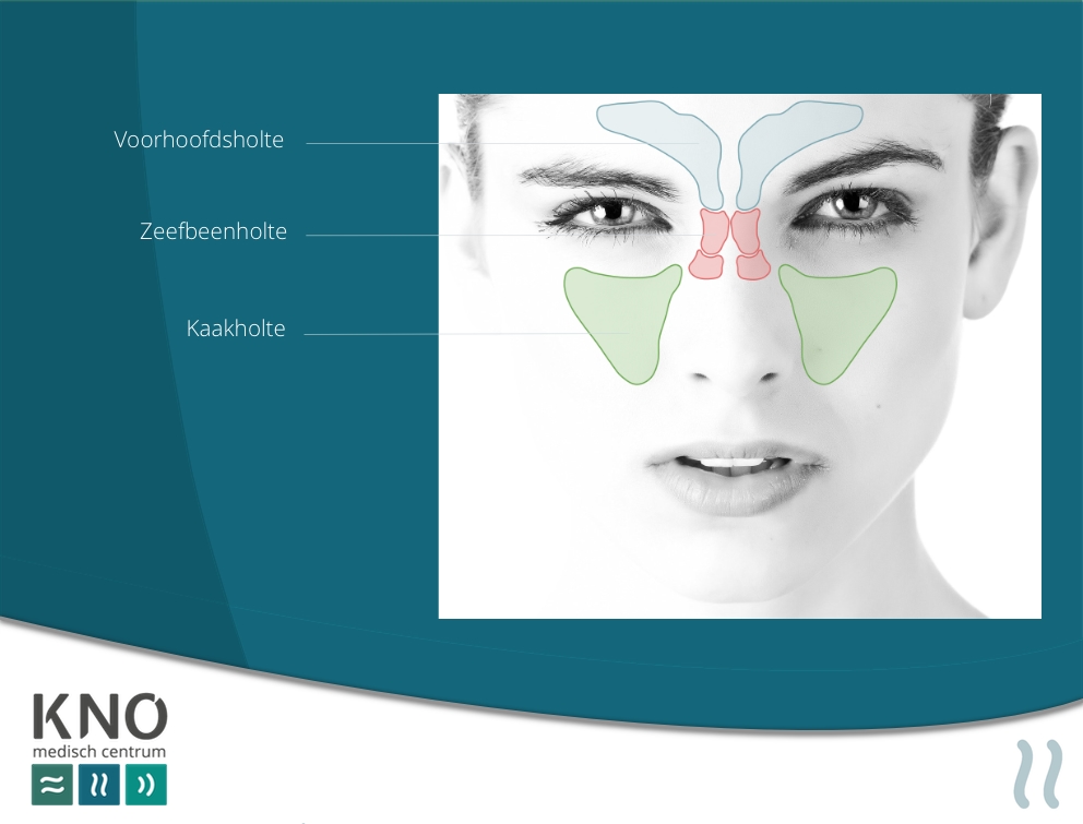 neusbijholte ontsteking