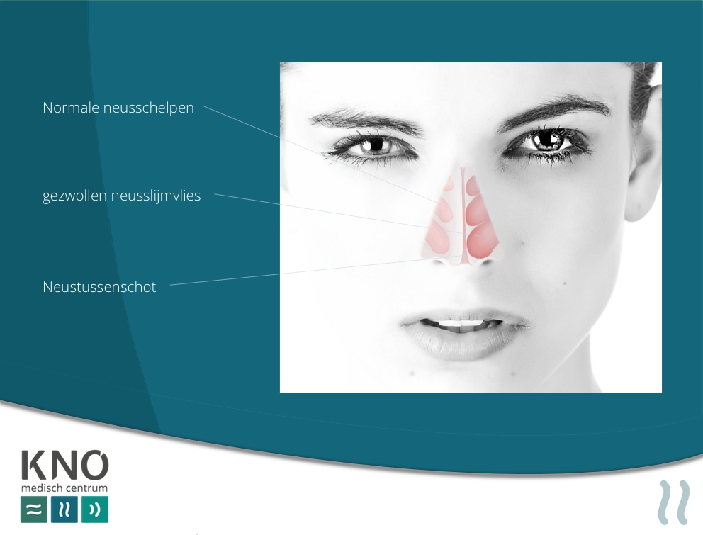 Allergiecentrum KNO MC